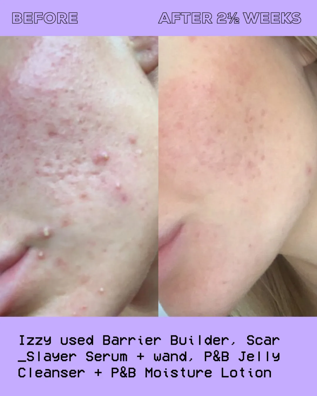 Purify & Brighten Moisture Lotion